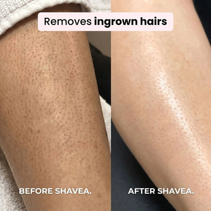 Shavea™ 2‑in‑1 Bikini & Body Trimmer