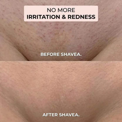 Shavea™ 2-in-1 Bikini & Body Hair Remover